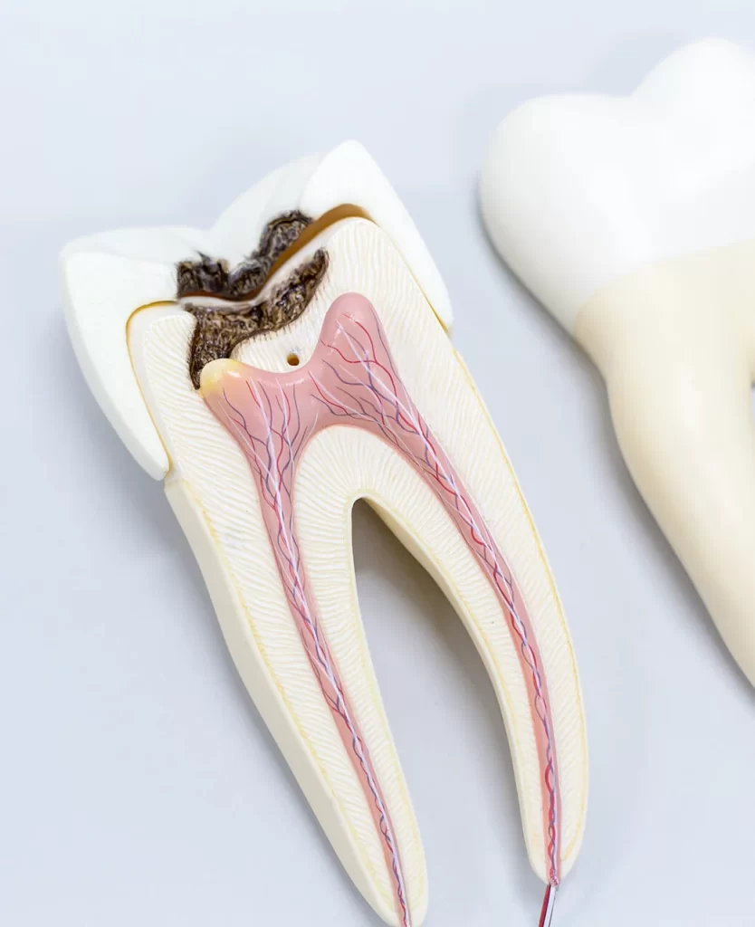 Root Canal Retreatment banner